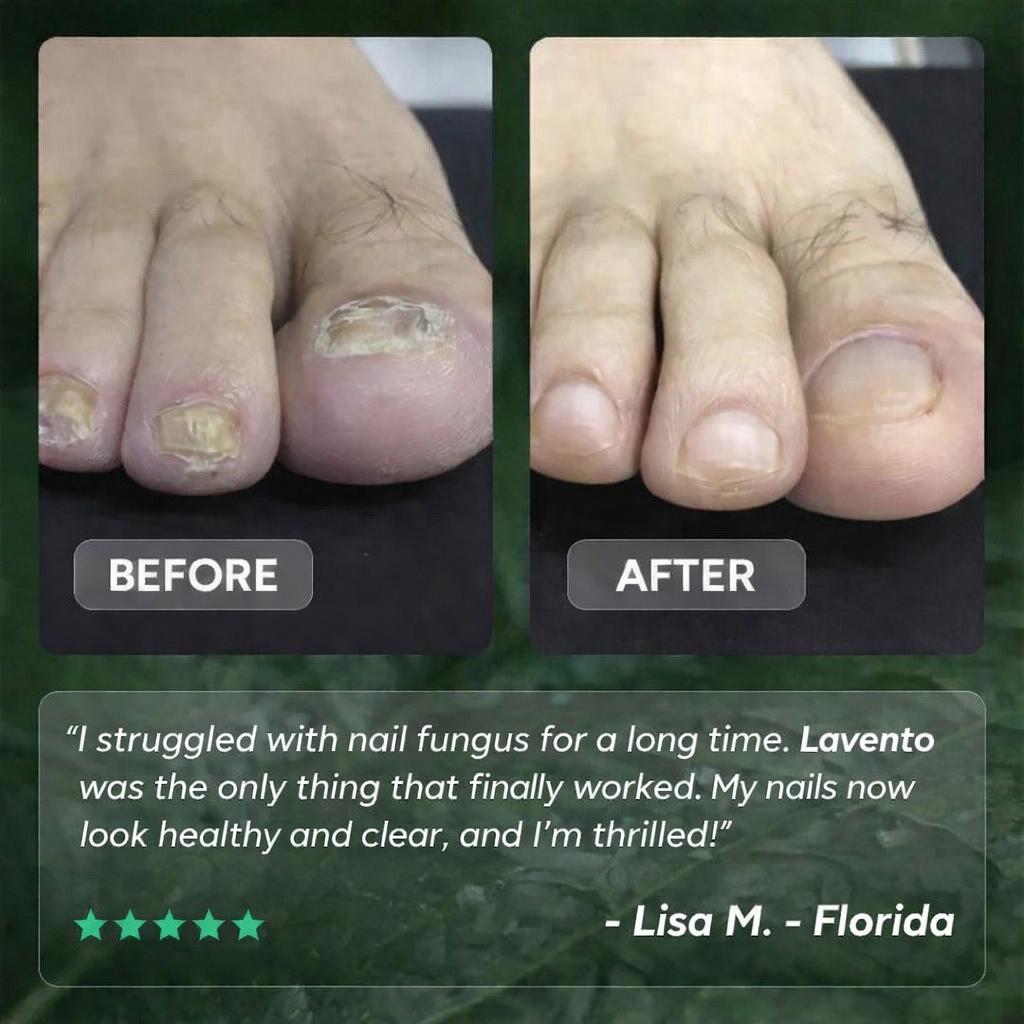 Nail Renewal Treatment Gel